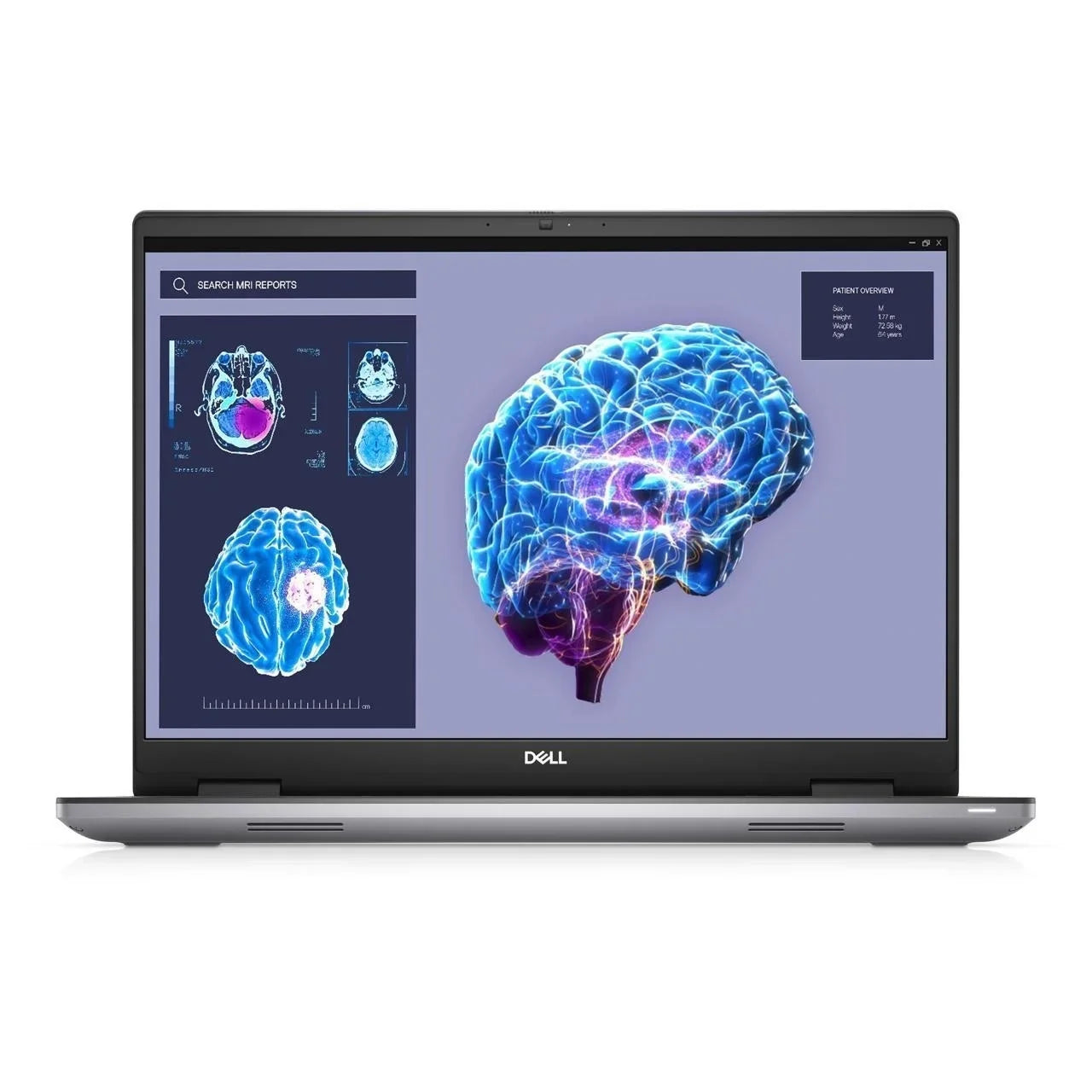 Dell Precision 16 7680 16" 32GB 256GB SizeSizeD Core™ i5-13600HX 4.8GHz WIN11P, Gray (Used - Good)