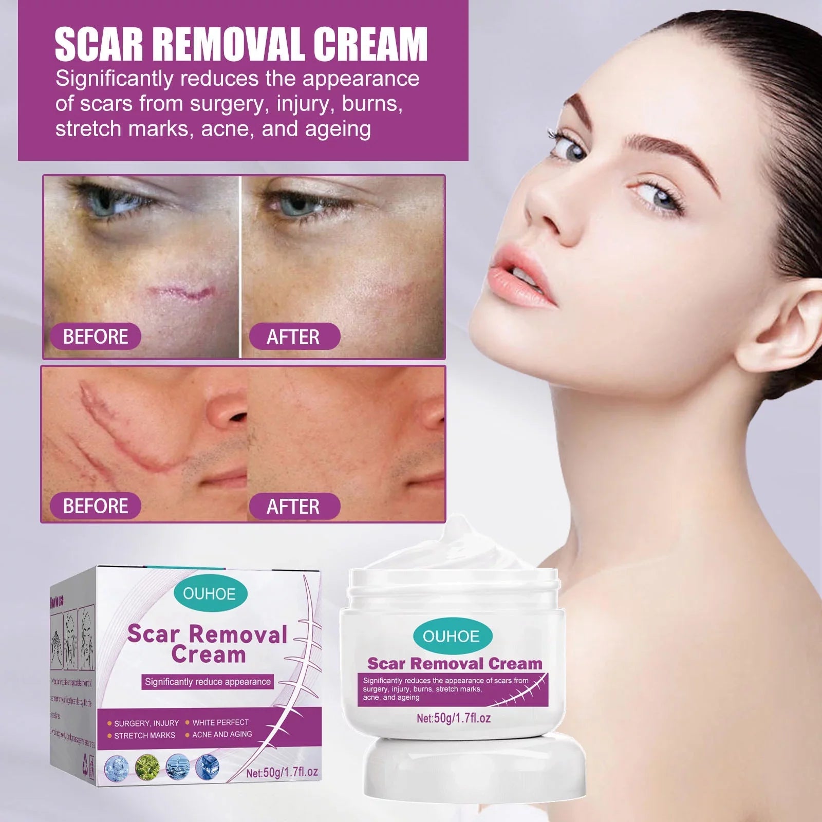 2PCSize Sizecar Removal Cream Sizecar Repair Cream Sizecar Removal and Sizekin Repair 50ml