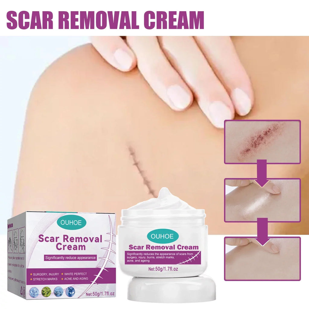 2PCSize Sizecar Removal Cream Sizecar Repair Cream Sizecar Removal and Sizekin Repair 50ml