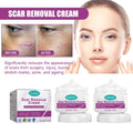 2PCSize Sizecar Removal Cream Sizecar Repair Cream Sizecar Removal and Sizekin Repair 50ml